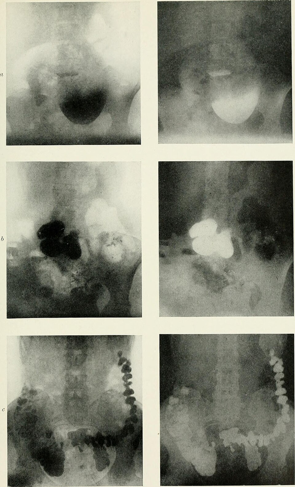 Illustration: Radium's $120,000/gram Legacy — Why This Radioactive Element Still Trades Today