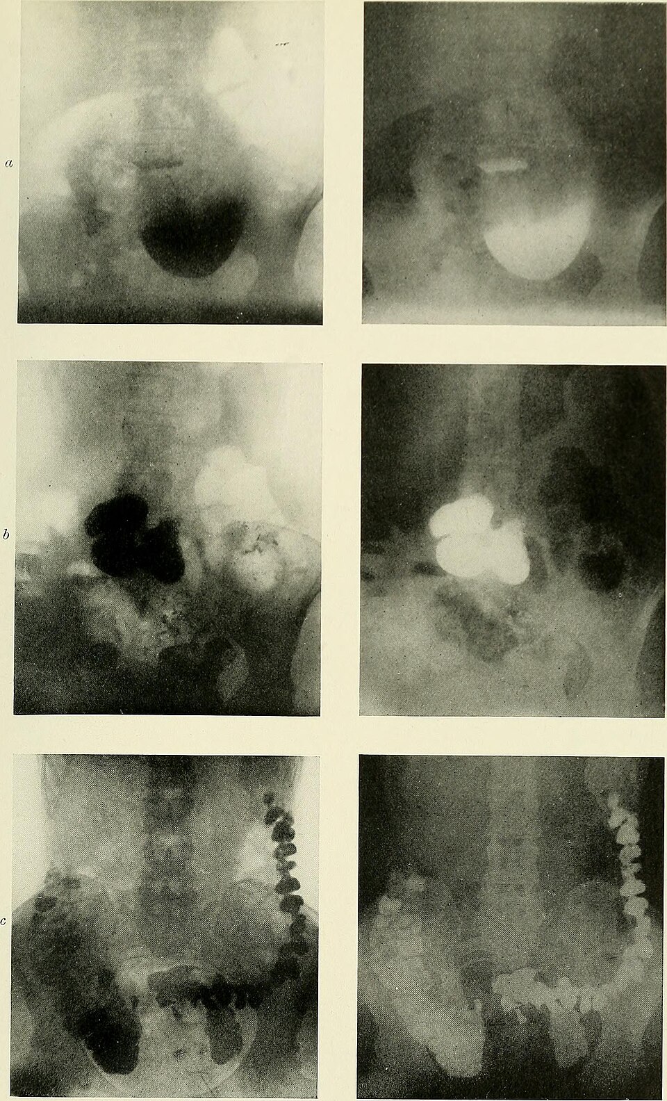 Illustration: Three Prediction Market Strategies for Radium Contracts