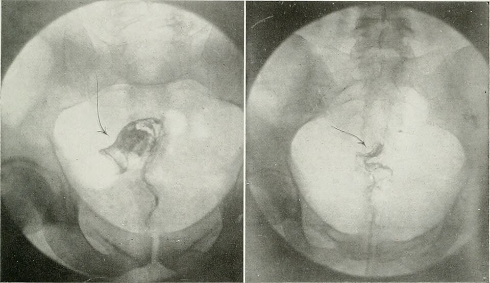 Illustration: Tools and Platforms for Radium Market Analysis